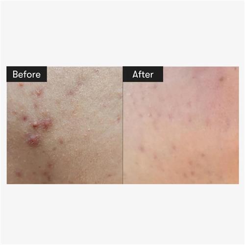 سرم ترمیم کننده ریدل شات 300 Cica & Hyalon حجم 50 میل