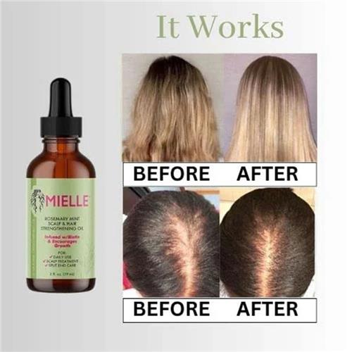 Mielle-Rosemary-Mint-Light-Scalp--Hair-Strengthening-Oil