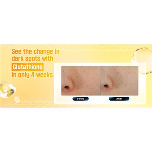 Numbuzin-No-5-Vitamin-Glutathione-Dark-Spot-Laser-Cream-