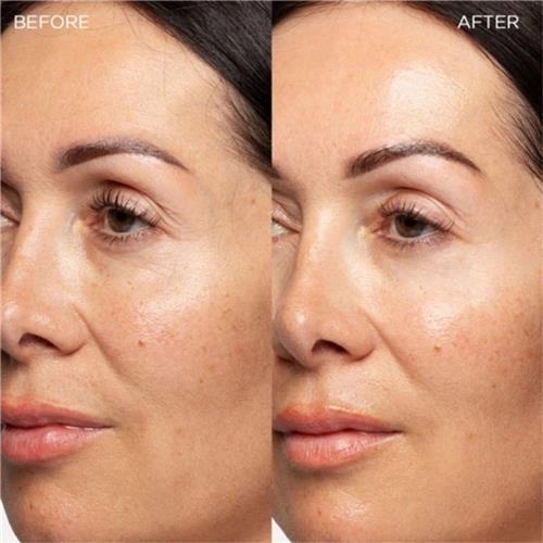 Collamin-Collagen-Bank